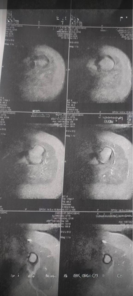 Em busca de esperança, pai procura o Agito Mais para pedir ajuda à filha de 4 anos com doença rara; Ajude!